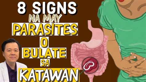 karaniwang dulot na sakit ng parasites|Bulate sa Tiyan: Lahat ng Dapat Malaman Tungkol sa .